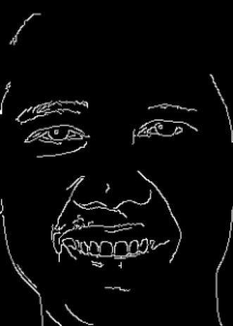 Integra Studio - Canny Edge Detection